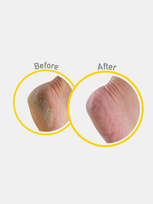 O'KEEFFE'S Healthy Feet Night Treatment 85 g