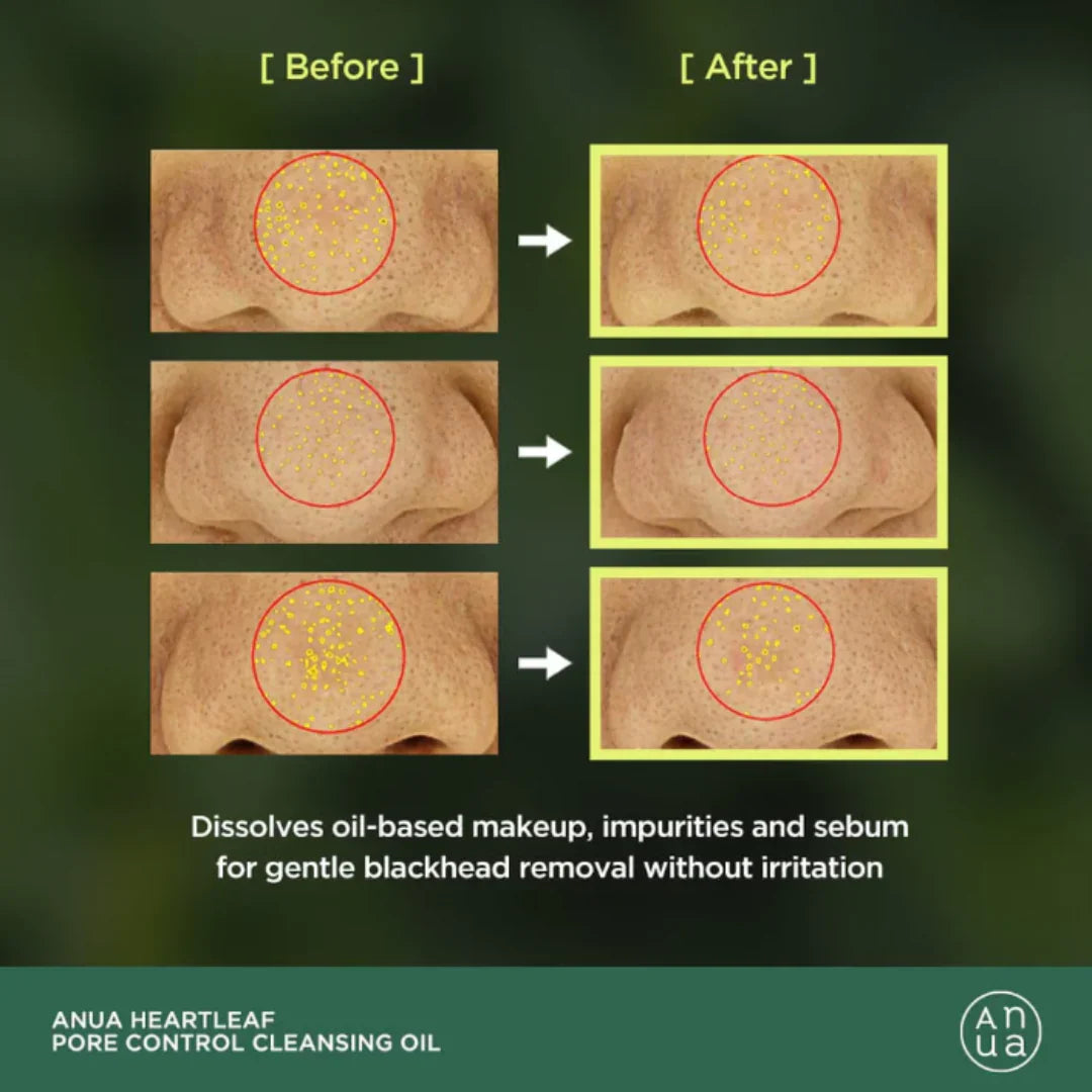 Anua Heartleaf Очищающее масло для контроля пор 200 мл