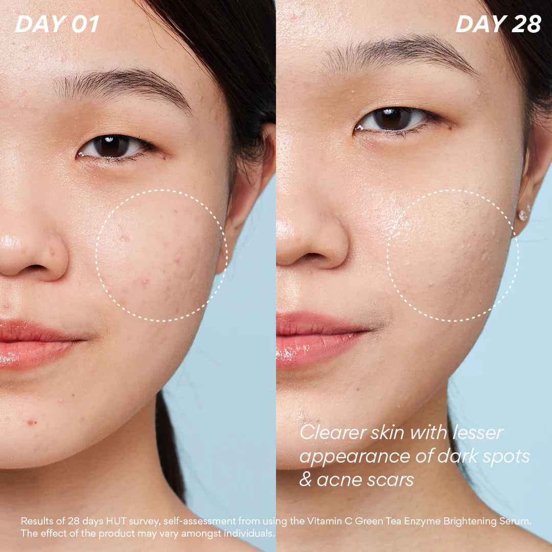 Innisfree Vitamine C Green Tea Enzyme Brightening Serum 30 мл