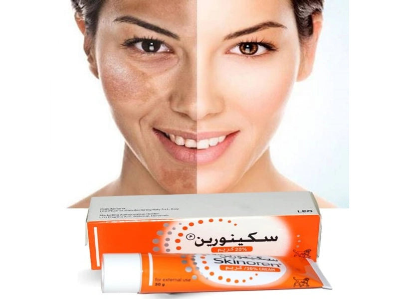 Skinoren 20% Cream 30 g