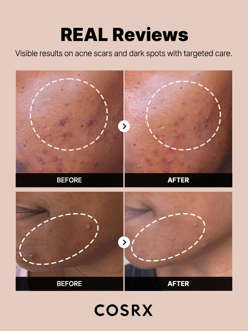 Cosrx The Alpha-Arbutin 2 Discoloration Care Serum 50 ml