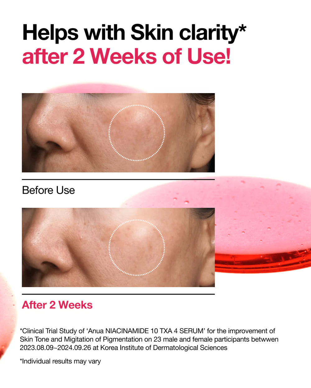 Anua Ниацинамид 10% + Txa 4% Сыворотка 30мл